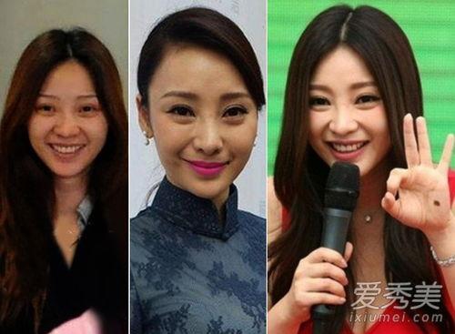 整容失败的明星网红照片,网红明星惨变“毁容”案例