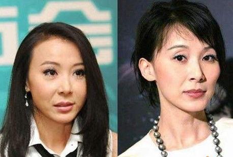 整容失败的明星网红照片,网红明星惨变“毁容”案例