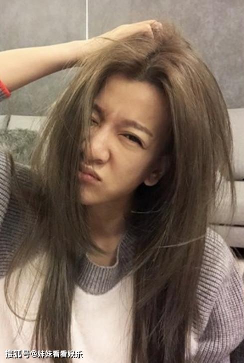 明星网红谁得过肾结石,健康警示与预防之道