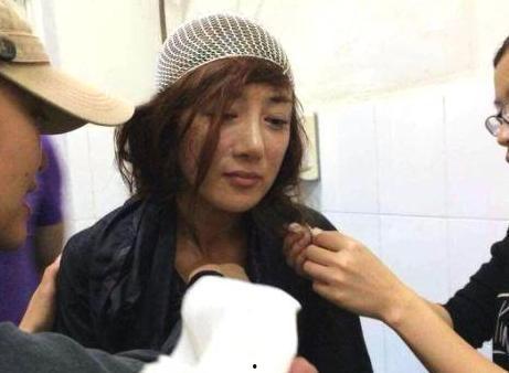 毁容的明星网红有哪些,那些因意外或事故毁容的明星网红