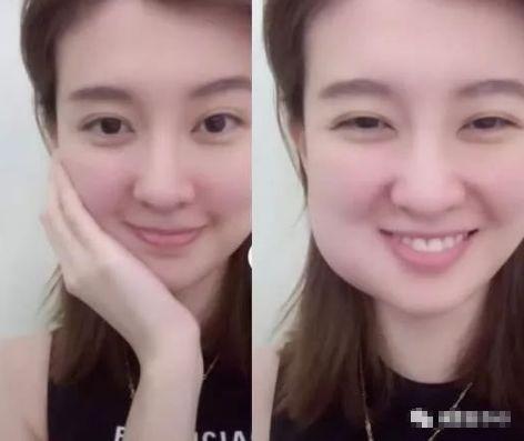 明星网红拔智齿视频播放